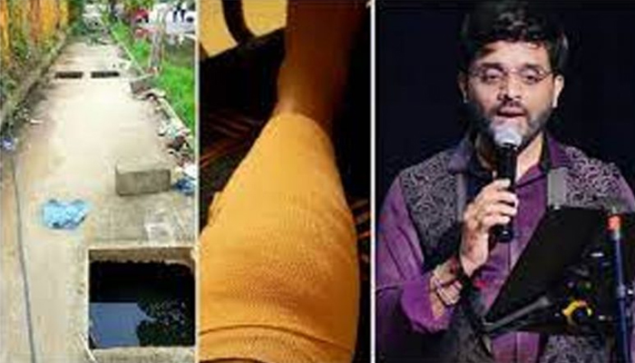 ರಸ್ತೆ ಗುಂಡಿಗೆ ಬಿದ್ದು ಕಾಲು ಮುರಿದುಕೊಂಡ ಗಾಯಕ, ಬಿಬಿಎಂಪಿ ವಿರುದ್ಧ ಅಸಮಾಧಾನ bbmp
