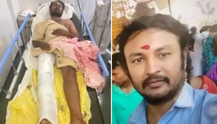 ತಪ್ಪಿಸಿಕೊಳ್ಳಲು ಯತ್ನಿಸಿದ ಆ್ಯಸಿಡ್ ನಾಗೇಶನ ಕಾಲಿಗೆ ಗುಂಡೇಟು! nagesh