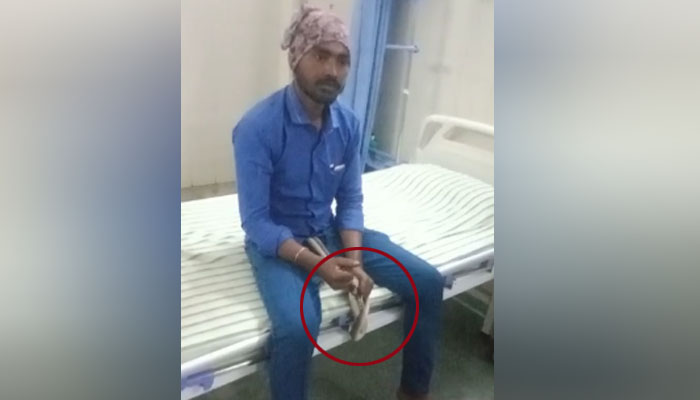 ತನಗೆ ಕಚ್ಚಿದ ಹಾವನ್ನು ಕೈಯಲ್ಲಿ ಹಿಡಿದು ಆಸ್ಪತ್ರೆಗೆ ಬಂದ ಕಾರ್ಮಿಕ! chikkamagaluru