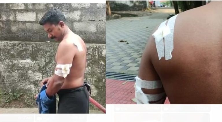 ವಿಶ್ವಕಪ್ನ ಉತ್ಸಾಹ ಮಿತಿ ಮೀರಿದೆ; ಕಣ್ಣೂರಿನಲ್ಲಿ ಮೂವರು ಗಾಯಗೊಂಡಿದ್ದಾರೆ. vishwakappu