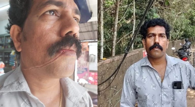 ಕೊಚ್ಚಿಯಲ್ಲಿ ಕೇಬಲ್ ಅವಘಡ kebal