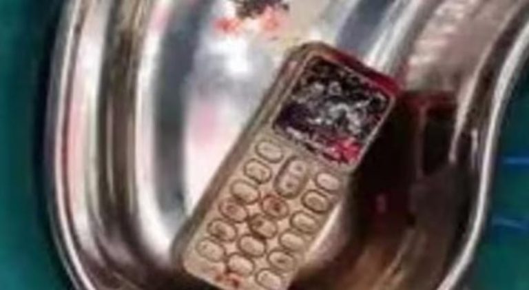 ಸಹೋದರನೊಂದಿಗೆ ಜಗಳ : ಯುವತಿ ತನ್ನ ಮೊಬೈಲ್ ಫೋನ್ ನುಂಗಿದ ವಿಚಿತ್ರ ಘಟನೆ phone