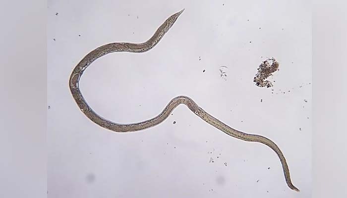 ಚರ್ಮದ ಒಳಗೆ ಹರಿದಾಡುತ್ತಿರುವ ಹುಳುಗಳು; ವೈದ್ಯ ಲೋಕಕ್ಕೆ ಅಚ್ಚರಿ worms