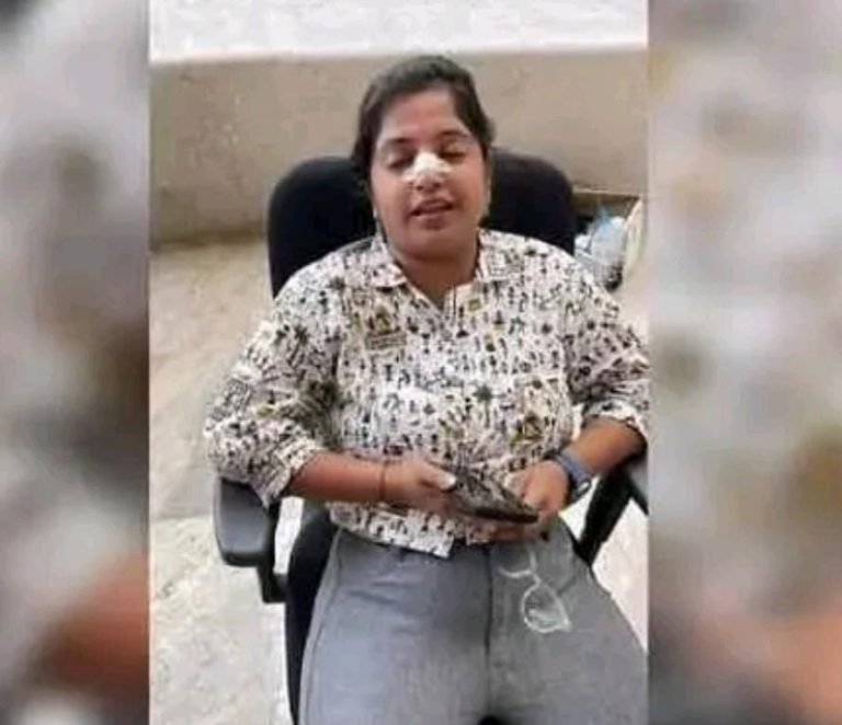 ವಿಮಾನ ನಿಲ್ದಾಣದಲ್ಲಿ ಪಾರದರ್ಶಕ ಗಾಜಿಗೆ ಗುದ್ದಿಕೊಂಡು ಮೂಗಿನ ಮೂಳೆ ಮುರಿದುಕೊಂಡ ಮಹಿಳೆ nisha