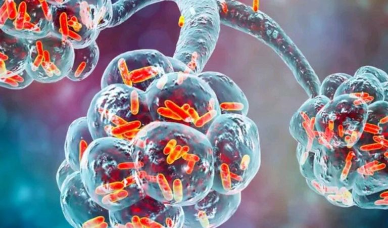 ನ್ಯುಮೋನಿಯಾ ವೈರಸ್: ದೇಶಾದ್ಯಂತ ಹೈ ಅಲರ್ಟ್ numonia cover