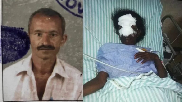 ಸಚಿವೆ ಲಕ್ಷ್ಮೀ ಹೆಬ್ಬಾಳ್ಕರ್ ರವರ ತವರು ಕ್ಷೇತ್ರದಲ್ಲಿ ಅಂಗನವಾಡಿ ಸಹಾಯಕಿ ಮೂಗು ಕತ್ತರಿಸಿ ರಾಕ್ಷಸೀ ಕೃತ್ಯ belagavi