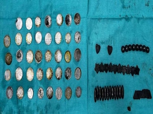 ಬಲಿಷ್ಠ ದೇಹ ಹೊಂದಲು ನಾಣ್ಯಗಳು ಮತ್ತು ಮ್ಯಾಗ್ನೆಟ್ ಗಳನ್ನು ನುಂಗಿದ್ದ ವ್ಯಕ್ತಿ ಆಸ್ಪತ್ರೆಗೆ ದಾಖಲು coins