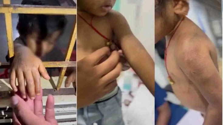 ಹೆತ್ತ ತಾಯಿಯಿಂದಲೇ 3 ವರ್ಷದ ಕಂದಮ್ಮನ ಮೇಲೆ ಹಲ್ಲೆ baby