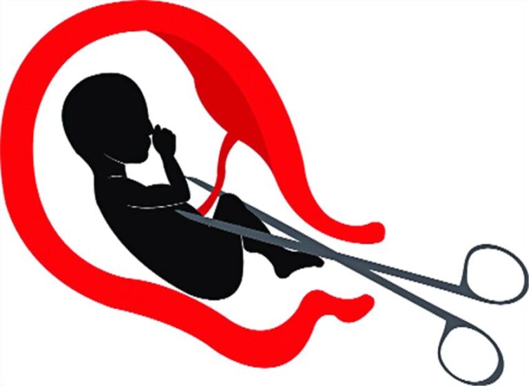 ಭ್ರೂಣ ಹತ್ಯೆ ಪ್ರಕರಣ: 25-30 ಸಾವಿರ ರೂ.ಗೆ ಕಂದಮ್ಮಗಳ ಉಸಿರು ನಿಲ್ಲಿಸುತ್ತಿದ್ದ ಪಾಪಿಗಳು fertilise