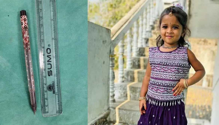 ಮಂಚದಿಂದ ಕೆಳಗೆ ಬಿದ್ದ ಮಗು: ಕೈಯಲ್ಲಿದ್ದ ಪೆನ್ ತಲೆಗೆ ಚುಚ್ಚಿ ಮಗು ಸಾವು bhaddrachalam